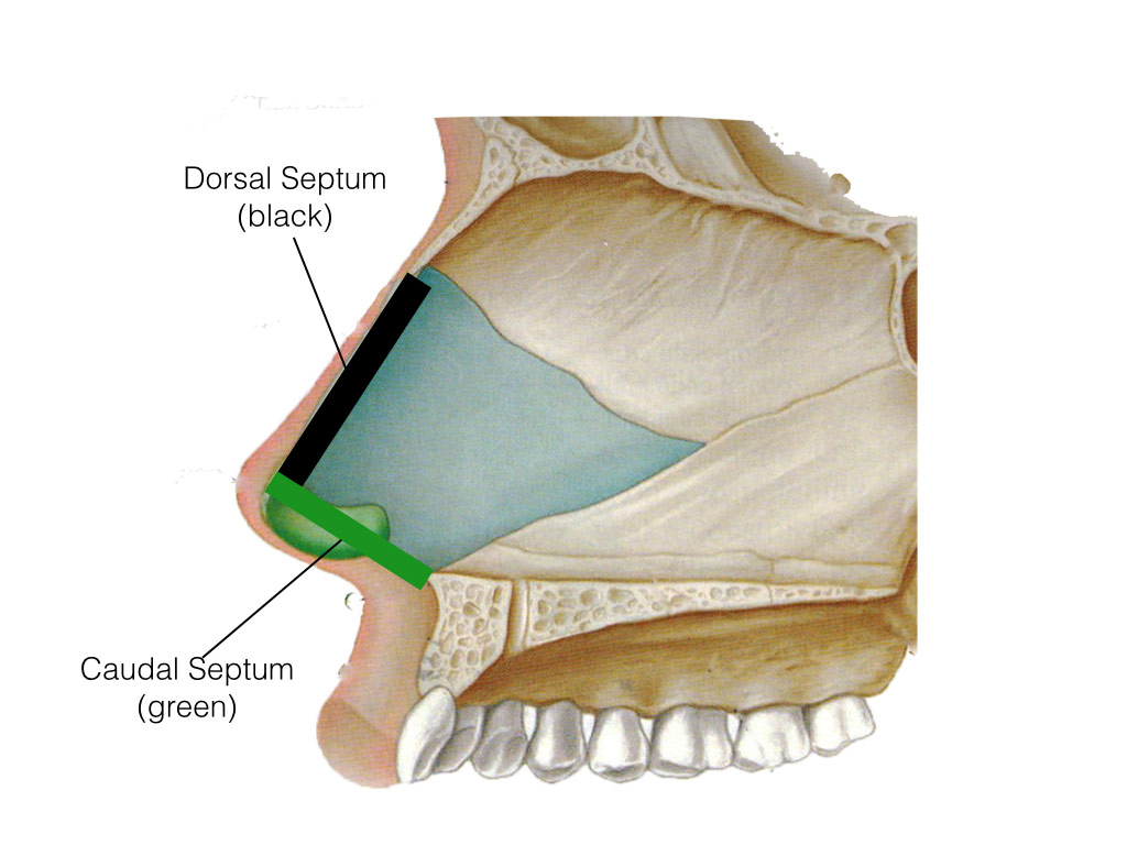 caudal-dorsal-septum