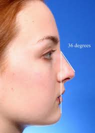 Nasofacial angle in facial analysis